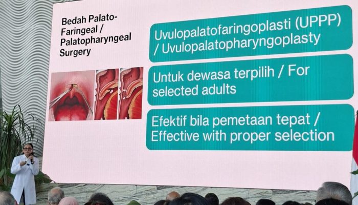 Mendengkur Bukan Pertanda Tidur Nyenyak Menurut Dokter
