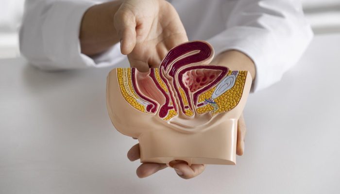 5 Pola Makan dan Gaya Hidup yang Dapat Memicu Wasir atau Ambeien menurut Dokter